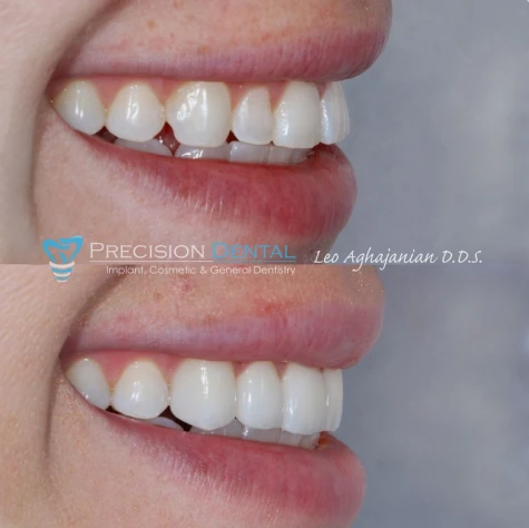 Before & After Case 1