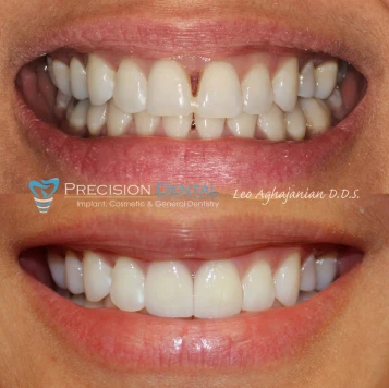 Before & After Case 2